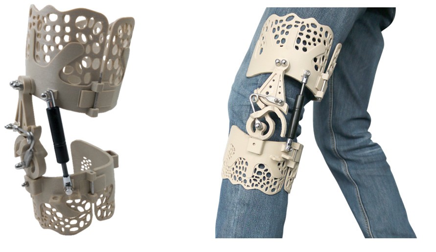 3D打印超輕型PEEK膝蓋支架 保護提高行走能力